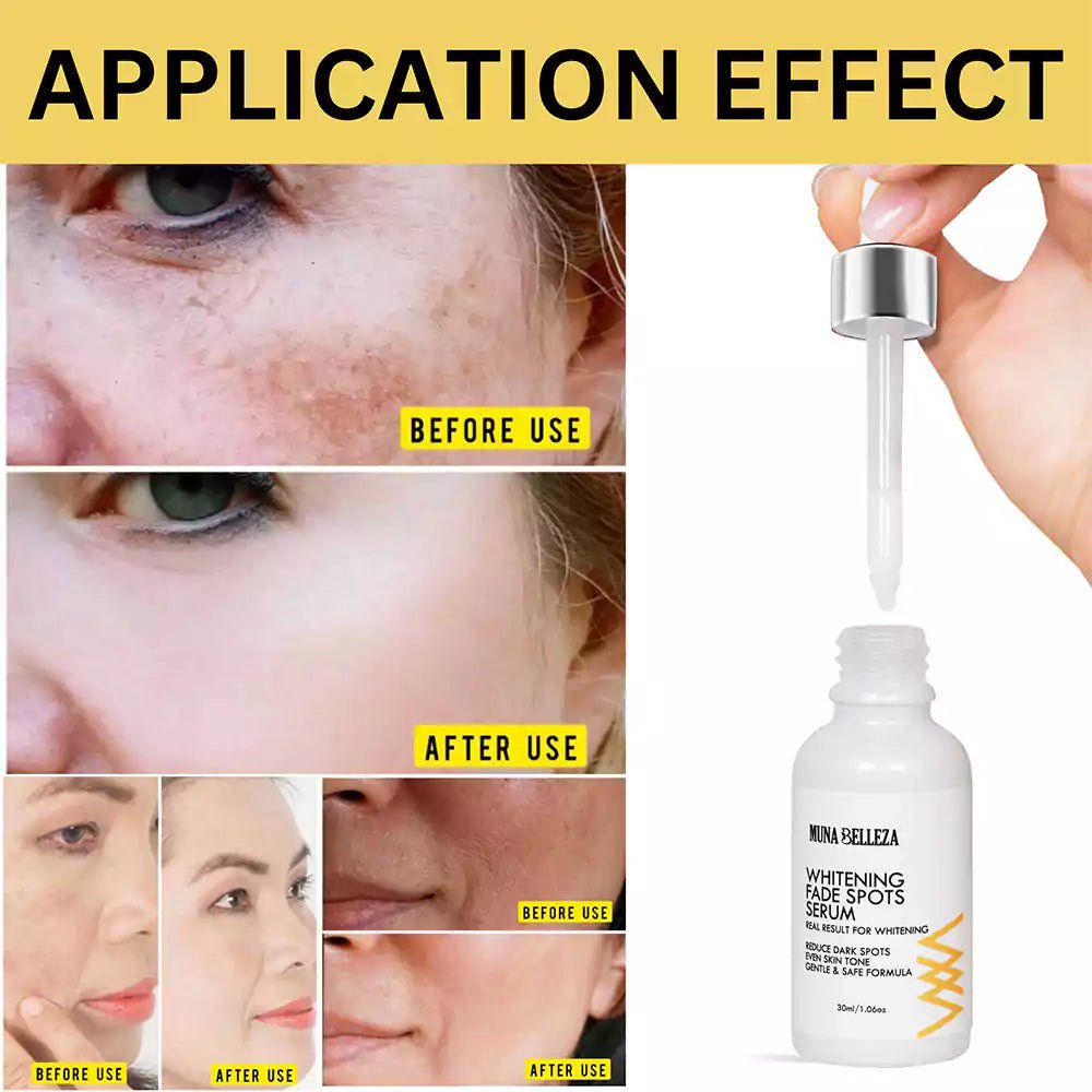 Dark Spot Correcting Serum With Niacinamide - Dark Spots Fade Serum - munabelleza