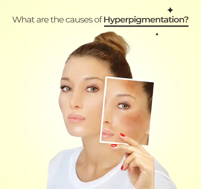 Woman holding a card showing dark spots on skin while asking what are the causes of hyperpigmentation, illustrating the need for an anti hyperpigmentation serum.