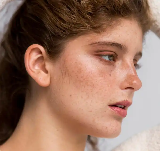 "Natural side profile of a woman with freckles and hyperpigmentation, suitable for serum product imagery."